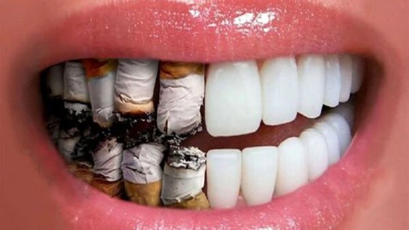 زراعة الأسنان للمدخنين مخاطرها
